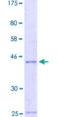 SDS-PAGE: Recombinant Human engrailed homeobox 2 GST (N-Term) Protein [H00002020-Q01]