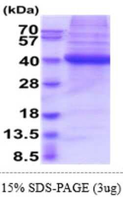 SDS-PAGE: Recombinant Human CD1d His Protein [NBP2-61180]