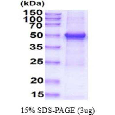 SDS-PAGE: Recombinant Human gamma Tubulin His Protein [NBP1-72534]