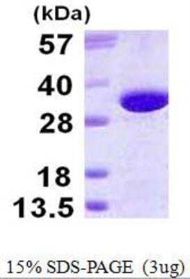 SDS-PAGE: Recombinant Human gamma-glutamyl hydrolase His Protein [NBP1-78898]