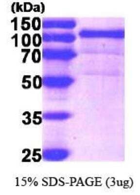 SDS-PAGE: Recombinant Human gp96/HSP90B1/GRP94 His Protein [NBC1-21058]