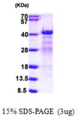 SDS-PAGE: Recombinant Human hnRNP C1 + C2 His Protein [NBP1-51035]