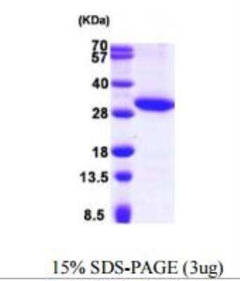 SDS-PAGE: Recombinant Human hydroxysteroid (17-beta) dehydrogenase 11 His Protein [NBP1-50932]