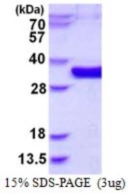 SDS-PAGE: Recombinant Human mediator of cell motility 1 His Protein [NBP1-98912]