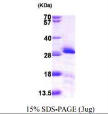 SDS-PAGE: Recombinant Human mtTFA His Protein [NBP1-50977]