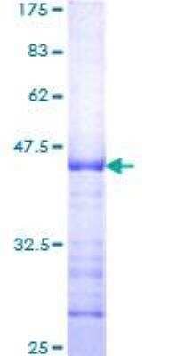 SDS-PAGE: Recombinant Human n-Myc GST (N-Term) Protein [H00004613-Q01]