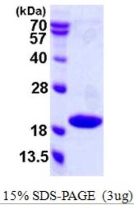 SDS-PAGE: Recombinant Human p18INK4c/CDKN2C His Protein [NBP1-78876]