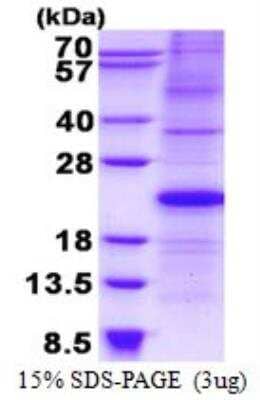 SDS-PAGE: Recombinant Human p21/CIP1/CDKN1A His Protein [NBP2-22976]