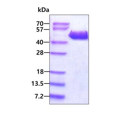 SDS-PAGE: Recombinant Human p38 gamma/SAPK3 His Protein [NBP1-72551]