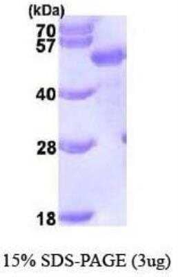 SDS-PAGE: Recombinant Human p62/SQSTM1 His Protein [NBP1-44490]