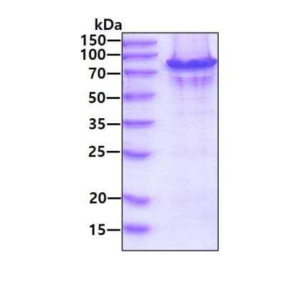 SDS-PAGE: Recombinant Human p70 S6 Kinase/S6K Isoform a His Protein [NBP2-61989]