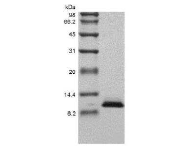 SDS-PAGE: Recombinant Human NT-proBNP Protein [NBP2-61321]