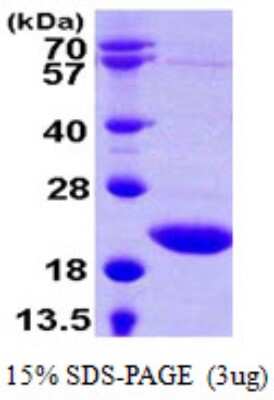 SDS-PAGE: Recombinant Human sen15 His Protein [NBP1-72318]
