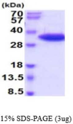 SDS-PAGE: Recombinant Human t-Plasminogen Activator/tPA His Protein [NBP2-59553]