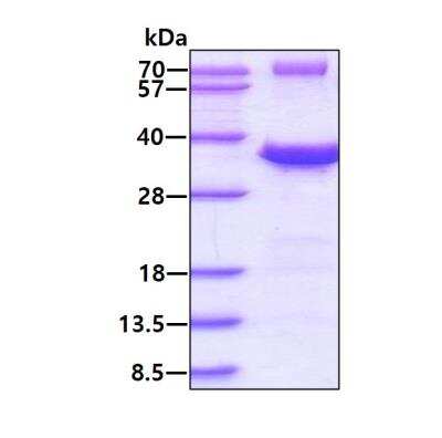 SDS-PAGE: Recombinant Human tropomyosin-3 His Protein [NBP1-78867]