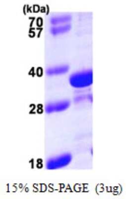 SDS-PAGE: Recombinant Human tropomyosin-4 His Protein [NBP1-51062]