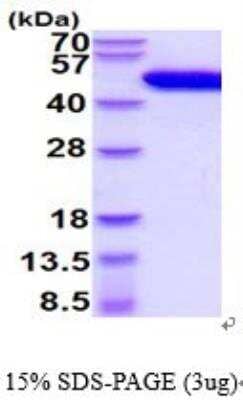 SDS-PAGE: Recombinant Human u-Plasminogen Activator/Urokinase His Protein [NBP2-52360]