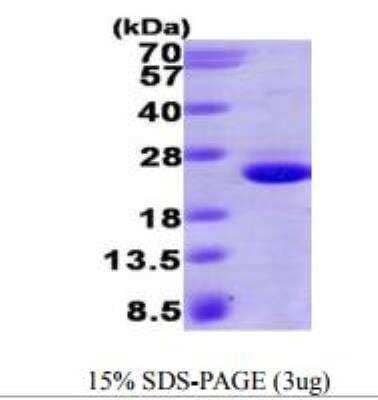 SDS-PAGE: Recombinant Human HRAS His Protein [NBP1-50831]