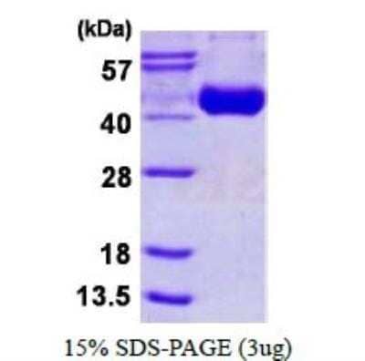 SDS-PAGE: Recombinant Influenza A H3N2 Hemagglutinin (A/canine/Guangdong/1/2006) His Protein [NBP1-99037]