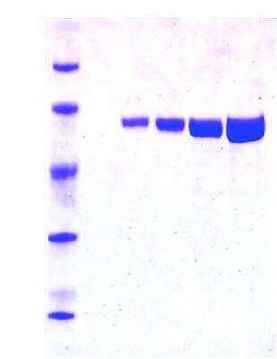 SDS-PAGE: Recombinant Luciferase (firefly) Protein [NBP3-18743]