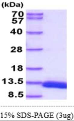 SDS-PAGE: Recombinant Mouse ACBP Isoform 2 His Protein [NBP2-61996]