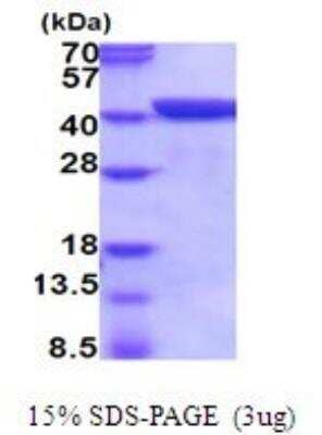 SDS-PAGE: Recombinant Mouse Annexin A1 His Protein [NBP2-52001]