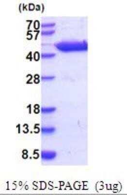 SDS-PAGE: Recombinant Mouse Aspartate Aminotransferase His Protein [NBP2-52088]