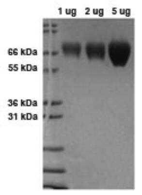 SDS-PAGE: Recombinant Mouse B7-1/CD80 Protein [NBP2-26578]