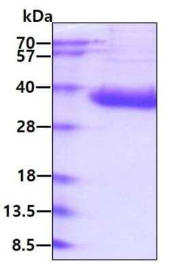 SDS-PAGE: Recombinant Mouse B7-H3/CD276 His Protein [NBP2-77491]