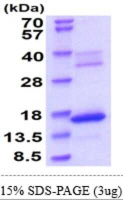 SDS-PAGE: Recombinant Mouse Bax His Protein [NBP2-61456]