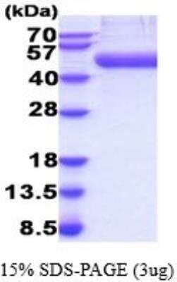 SDS-PAGE: Recombinant Mouse CD14 His Protein [NBP2-52177]