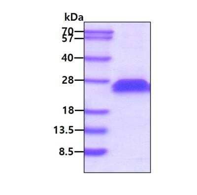 SDS-PAGE: Recombinant Mouse CD40/TNFRSF5 His Protein [NBP2-52199]