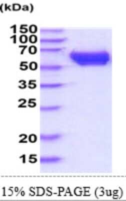 SDS-PAGE: Recombinant Mouse CRMP1 His Protein [NBP2-61458]