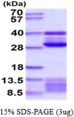 SDS-PAGE: Recombinant Mouse Cathepsin S His Protein [NBP2-52349]