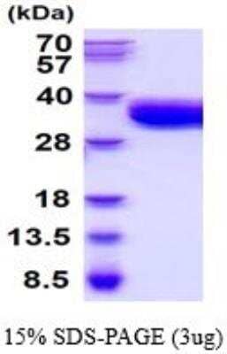 SDS-PAGE: Recombinant Mouse Coagulation Factor III/Tissue Factor His Protein [NBP2-52327]