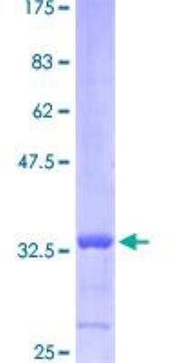 SDS-PAGE: Recombinant Mouse Complement C3 GST (N-Term) Protein [P3343]