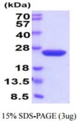 SDS-PAGE: Recombinant Mouse Cyclophilin B His Protein [NBP2-59665]