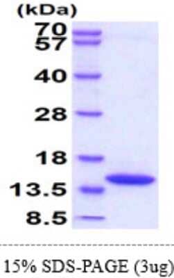 SDS-PAGE: Recombinant Mouse DDT His Protein [NBP2-61995]