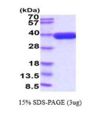 SDS-PAGE: Recombinant Mouse EGF-L6 His Protein [NBP2-77500]