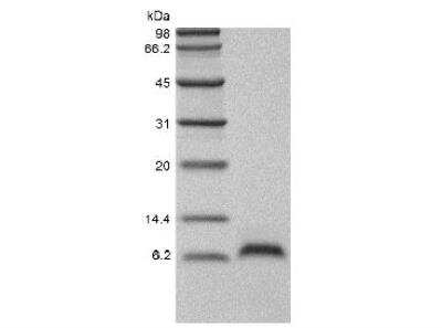 SDS-PAGE: Recombinant Mouse EGF Protein [NBP2-35176]