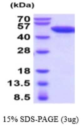 SDS-PAGE: Recombinant Mouse Enolase 2/Neuron-specific Enolase His Protein [NBP2-59536]