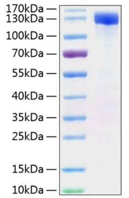 SDS-PAGE: Recombinant Mouse ErbB2/Her2 Fc His (C-Term) Protein [NBP3-18207]