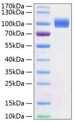 SDS-PAGE: Recombinant Mouse ErbB2/Her2 His (C-Term) Protein [NBP3-18206]