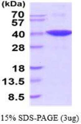 SDS-PAGE: Recombinant Mouse GAPDH His Protein [NBP2-52622]