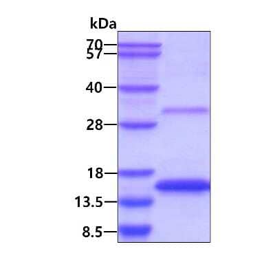 SDS-PAGE: Recombinant Mouse GDF-15 His Protein [NBP2-51921]