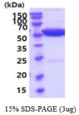 SDS-PAGE: Recombinant Mouse GPT His Protein [NBP2-59549]