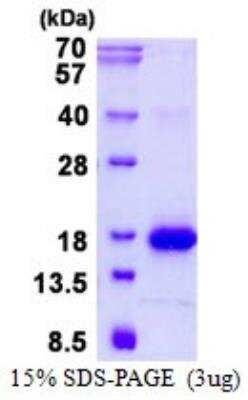 SDS-PAGE: Recombinant Mouse Galectin-1 His Protein [NBP2-23182]