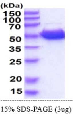 SDS-PAGE: Recombinant Mouse Guanine deaminase His Protein [NBP2-60220]