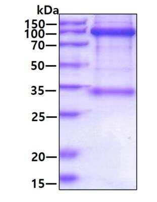 SDS-PAGE: Recombinant Mouse HGFR/c-MET hIgG-His Protein [NBP2-77485]