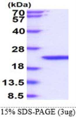 SDS-PAGE: Recombinant Mouse IFN-beta His Protein [NBC1-27971]